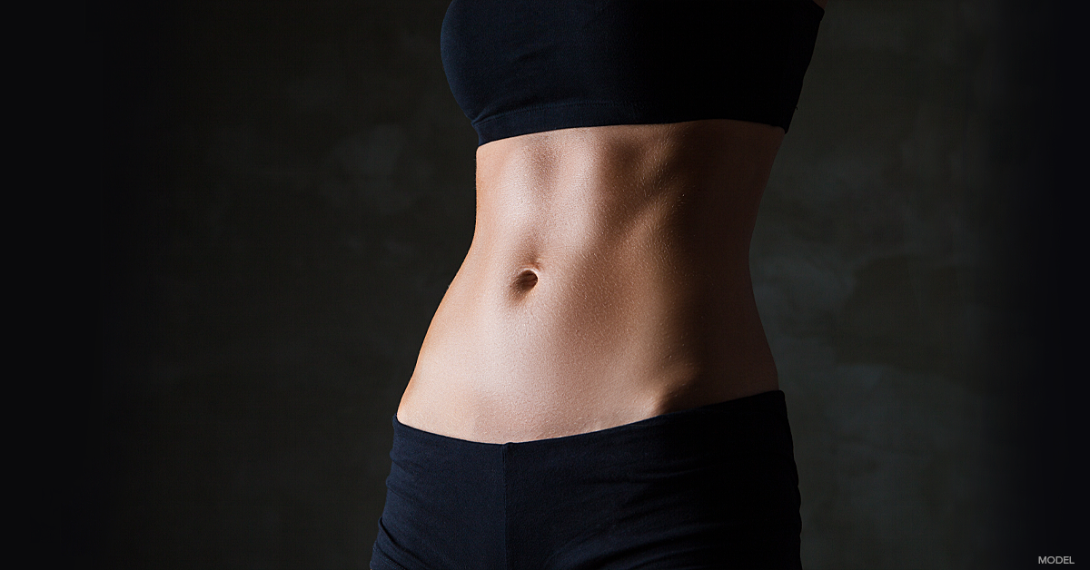 Woman's stomach following her tummy tuck procedure.